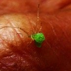 petite araignée et ses oeufs (2).JPG